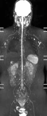 Whole-body imaging