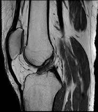Knee imaging