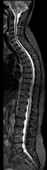 Spine imaging