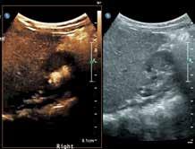 Contrast-enhanced liver imaging